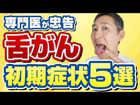 放置危険、治らない口内炎と舌がんの簡単な見分け方