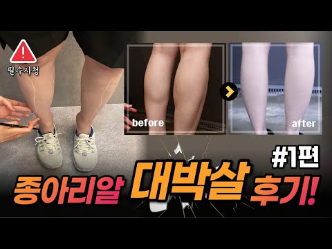 [하비들 주목] 종아리 진짜로 얇아질 수 있어요