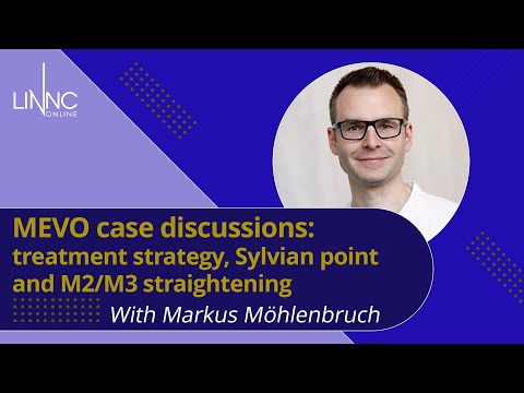 MEVO case discussions: treatment strategy, Sylvian point and M2/M3 straightening 2