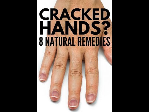 This Home Remedies for Dry and Rough Hands #Shorts