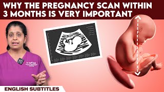 Why the pregnancy scan within 3 months is very important | கர்ப்ப காலத்தில் CRL அளவீடு முக்கியமா?