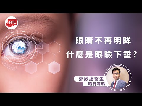 眼晴不再明眸｜甚麼是眼瞼下垂?