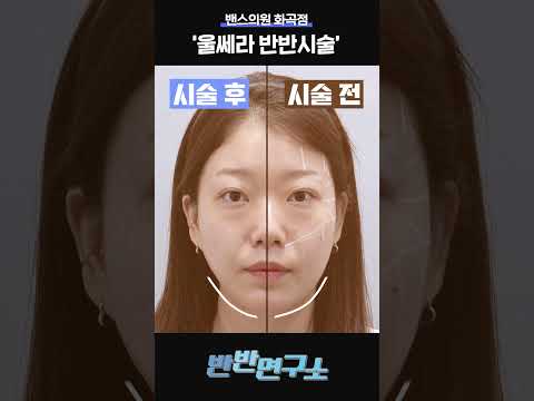 [밴스의원 강서화곡점]유지기간은 길고 만족도는 200% 가심비 최고 울쎄라 효과 보러가실까요?📢😯