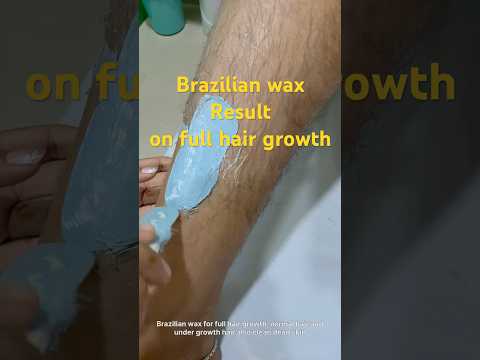 Hair Waxing Result l How To Apply Brazilian Wax l Brazilian Wax Result #bodywax #waxings #ricawax