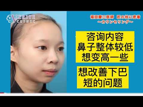 日本资深医美翻译“杨迪”vlog 整形大咖福田庆三医生咨询效果图设计大公开咨询内容