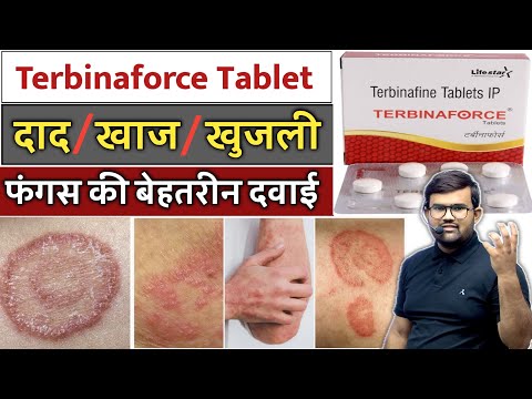 दाद, खाज, खुजली | Terbinaforce Tablet | Fungal Infection | Fungal Treatment | Medicine | Treatment