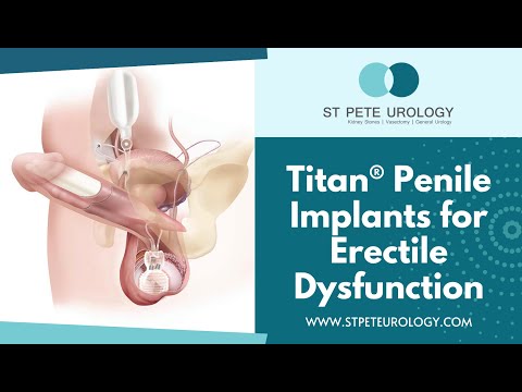 Titan® Penile Implants for Erectile Dysfunction