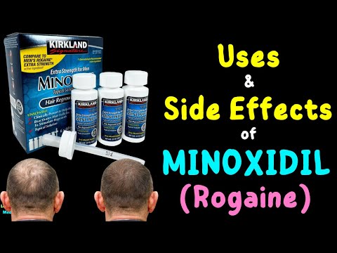 Minoxidil for Hair Loss Treatment | Minoxidil for Hair Growth - Rogaine