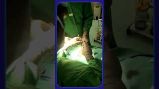 The Expert Guide to Stapler Circumcision | Urologist | Bhubaneswar | Dr. Biswajit Nanda