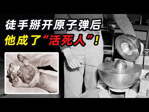 DNA断裂！皮肤溶解！徒手掰开原子弹后，他成了“活死人”