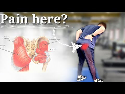 5 BEST Piriformis Syndrome/DGS Rehab Exercises!