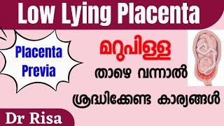 Low Lying Placenta in Pregnancy | Placenta Previa Malayalam