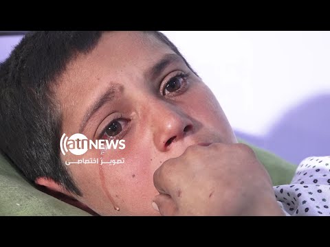 Boy's harrowing words after Pakistan airstrikes on Paktika|گفته‌های کودک  زخمی‌شده در حملات پاکستان