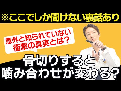 【意外と知らないことが発覚】骨切りによる嚙み合わせについて