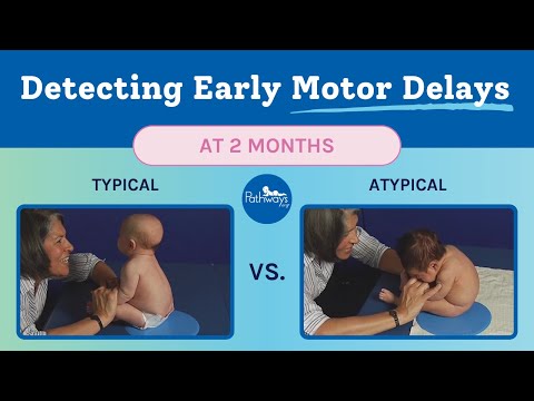 2 Month Typical & Atypical Development | Baby Motor Development Exam