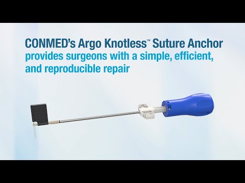 Argo Knotless® Suture Anchor - CONMED Product Video