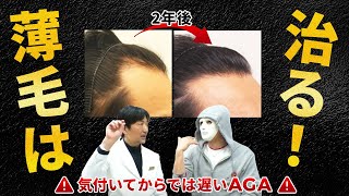 【AGA・ハゲ・薄毛を徹底解説！】AGAとは何？ブリーチしてる人は禿げやすいの？薄毛の原因は？予防法は何をすれば良いの？ラファエルさんが徹底的に質問します！【湘南美容クリニック】