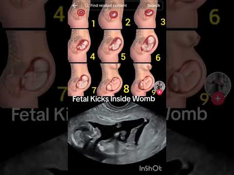 fetal Kicks inside Womb #babyultrasound #pregnancyscan #baby