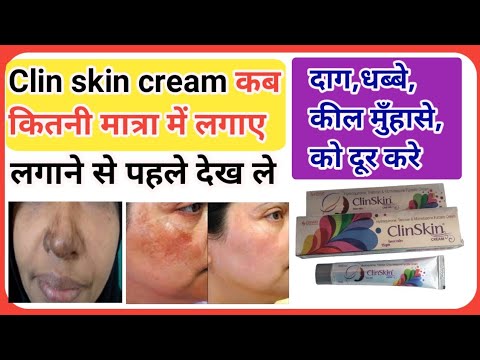 Clin skin cream कब व कितनी मात्रा में लगाए l When and in what quantity to apply Clin skin cream?