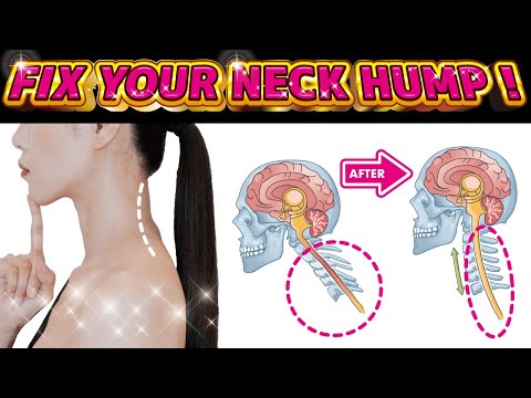 How to Fix a Neck Hump and Slim Face | Can be done while sitting in a chair