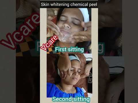 VCare skin whitening chemical peel 👩‍🦰// #shorts #youtubeshorts