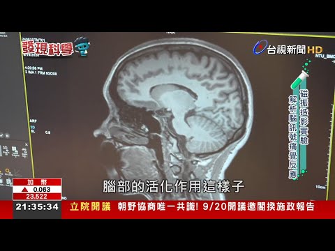 影響安慰劑效應 研究大腦痛覺機制解謎