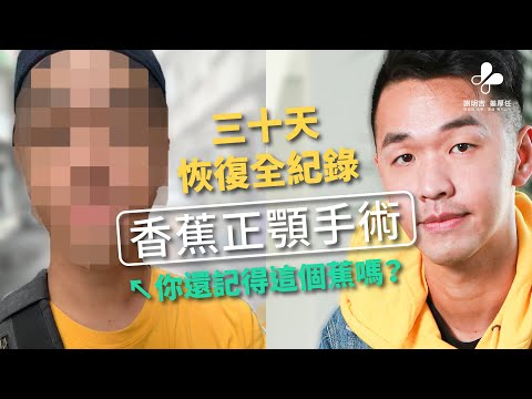 謝明吉醫師-香蕉超震撼正顎手術恢復過程，首度公開！！！