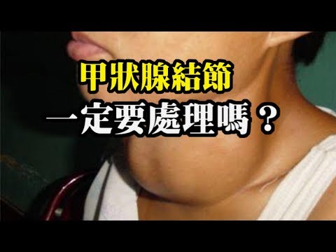 甲狀腺結節一定要處理嗎？