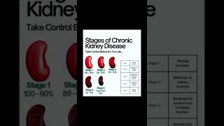 Stages of chronic kidney disease #kidney #human #doctor #kidneyawareness