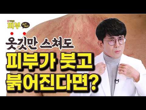 사소한 자극에도 피부가 항상 비상 상태? 피부 묘기증의 원인과 치료법 - 박치영의 피부 톡톡 #135