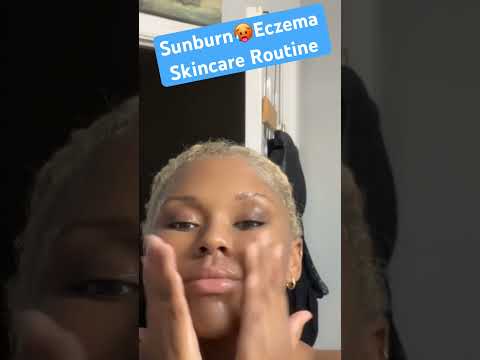 Sunburn Eczema #skincareroutine #dryskinrelief #enigmaticspace #ugccreator  #blackcontentcreators