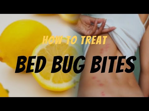 Bed Bug Bite Relief: Effective Ways to Treat Bed Bug Bites - Remedies & Tips