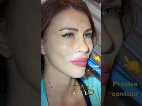 Scarless facelift by Prof.Dr.Suleyman Tas #drsuleymantas