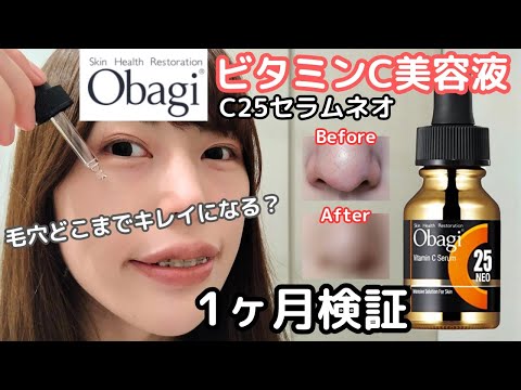 【毛穴消える？】オバジのビタミンC美容液１ヶ月使ってみた！