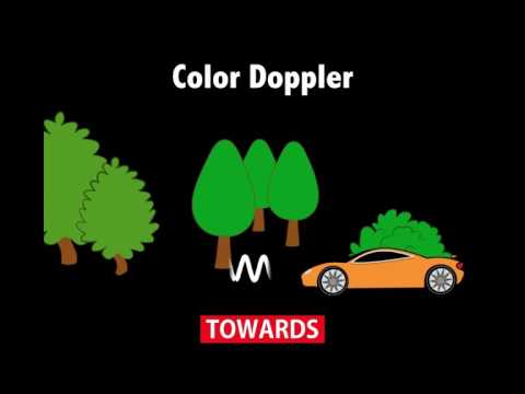 Ultrasound Physics Scanning Modes Color Doppler