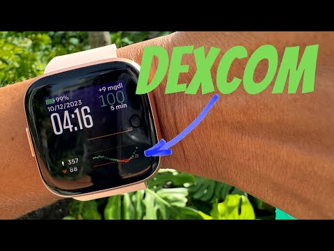 How to Get Dexcom CGM Readings on Your Fitbit Watch