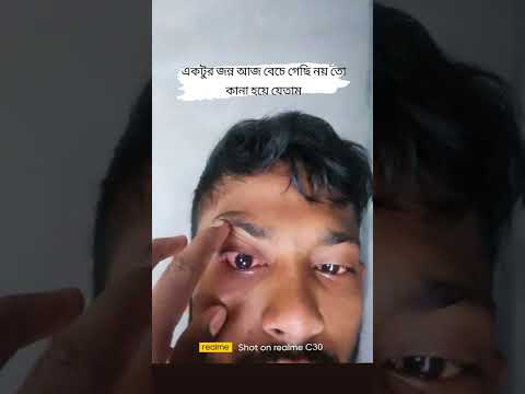 আলহামদুলিল্লাহ  আজ জিবোনের মতো আল্লা আমাকে বাচায় দিয়েছে,, 🤲🤲🤲🤲🤲