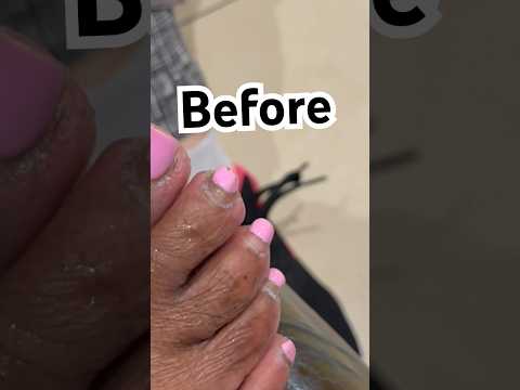 Extreme Spring Pedicure Makeover #feet