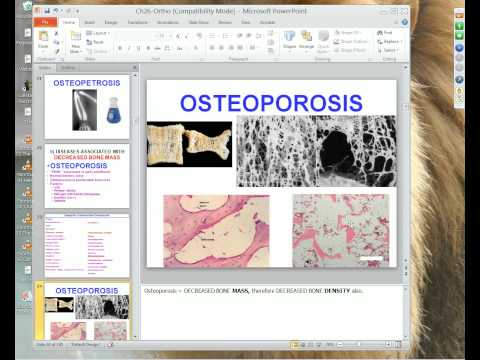 Medical School Pathology 2012 Session 072 Ortho I.mp4