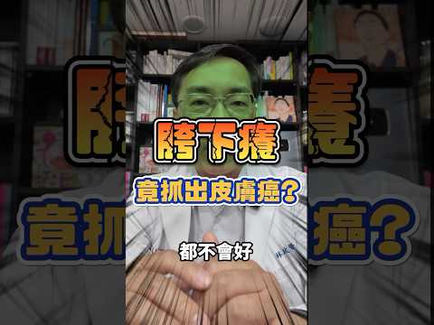 癢到GGYY，抓破皮看不好，經檢查竟發現是皮膚癌，真的GG了…#shorts