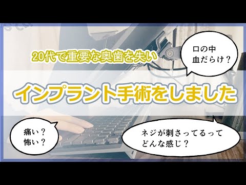 インプラントの手術をしたので情報共有します