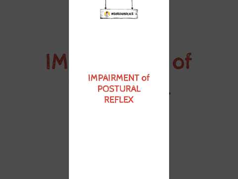 Condition that alter postural reflex #shortvideo #shorts