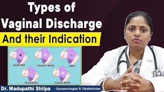 Different types of Vaginal Discharge and Indication | White Discharge | Dr Shilpa Women's Clinic