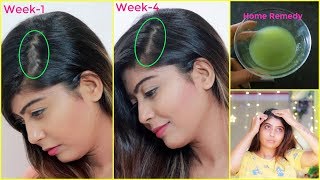 HOW I STOPPED MY HAIR FALL AND GROW HAIR FASTER 100% WORK | MY Personal Experience | Rinkal Soni