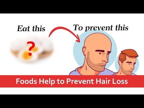 The best Vitamins and Minerals for Hair Growth, Best Foods that Help Prevent Hair Loss