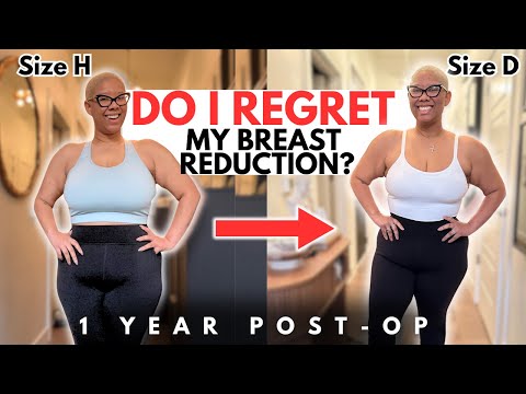 10 Things I Wish I Knew Before Having a Breast Reduction | 1 Year Post Op