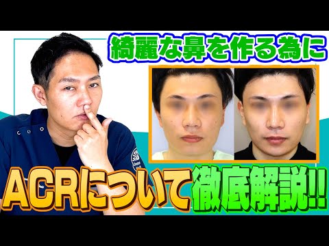 【鼻整形】ACRってなに？現役医師が徹底解説！#鼻整形 #ACR#表参道スキンクリニック