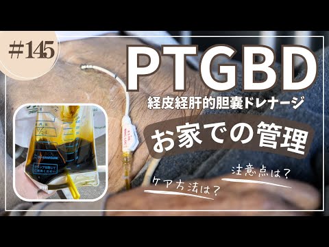 #145   PTGBD（経皮経肝的胆嚢ドレナージ）お家ので管理