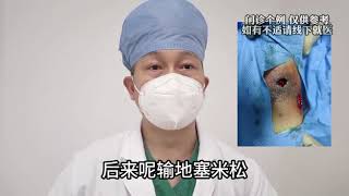 how to treat venous ulcer after DVT? 深静脉血栓后综合症并发溃疡如何处理？