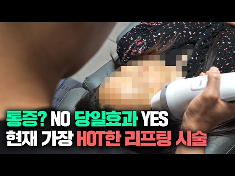 지금까지 이런 원리의 리프팅은 없었다 / 체외 충격파 레비나스 리프팅